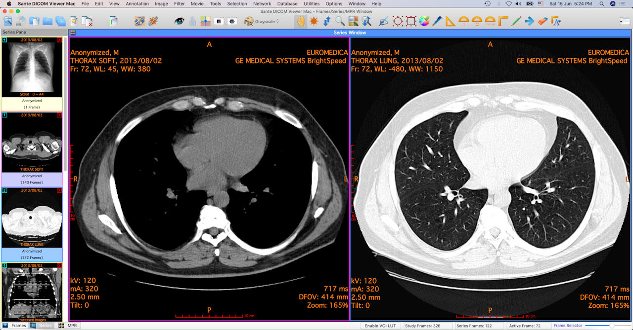 mri images viewer for mac